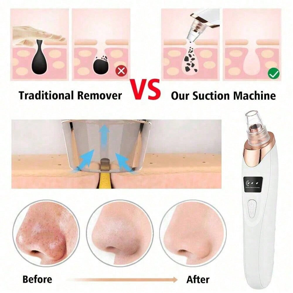 Comparison of traditional blackhead remover vs. a suction machine with before and after effects on skin.