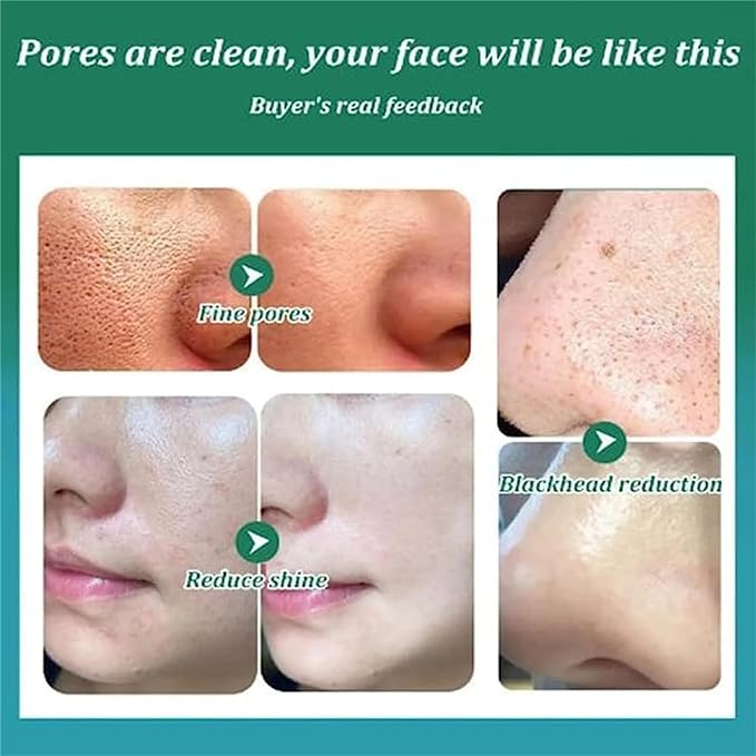 Collage of skin before and after using a product with text 'Pores are clean, your face will be like this' and 'Buyer's real feedback'.